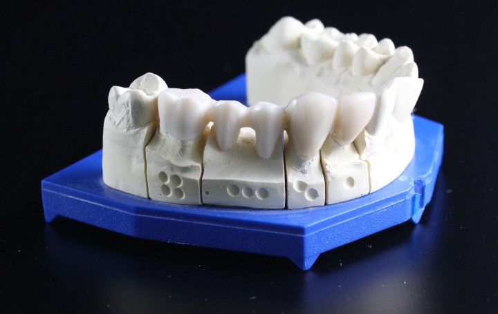 Peritaje dental analisis mordeduras